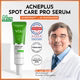 Y.O.U AcnePlus Spot Care Pro Serum 15g