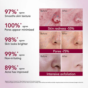 Y.O.U Reeffect Boost 12% Acid Intensive Peeling Serum