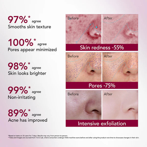 Y.O.U Reeffect Boost 12% Acid Intensive Peeling Serum