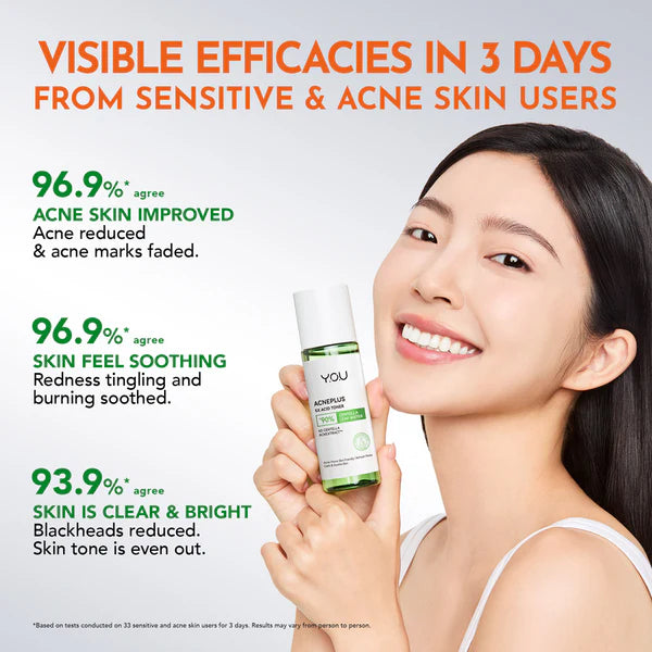 Y.O.U Acneplus 5X Acid Toner