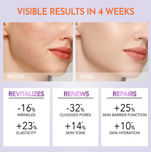 Y.O.U Reeffect Boost Renewal Retinol Moisturizer 30g