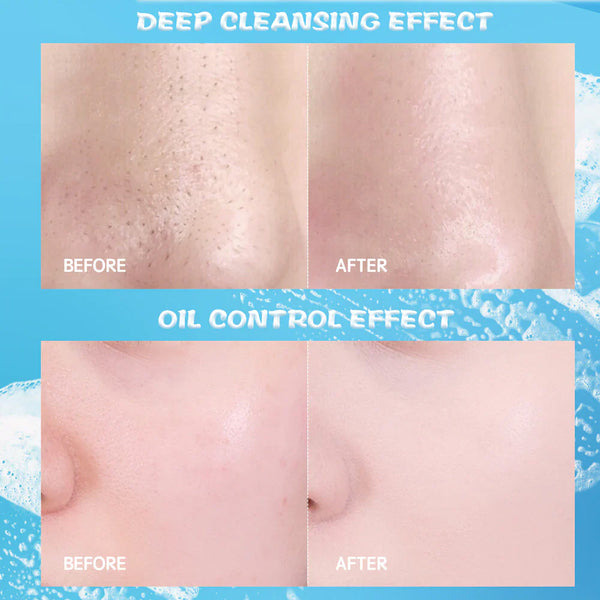 Y.O.U Hy! Amino Oil Control Facial Wash